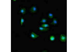 Immunofluorescent analysis of MCF-7 cells using ABIN7171915 at dilution of 1:100 and Alexa Fluor 488-congugated AffiniPure Goat Anti-Rabbit IgG(H+L) (TTC19 抗体  (AA 108-380))