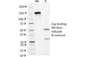 SDS-PAGE Analysis Purified CD1a Mouse Monoclonal Antibody (66IIC7). (CD1a 抗体)