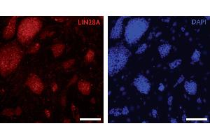 LIN28A antibody (pAb) tested by Immunocytochemistry Mouse embryonic stem cells (mESCs) grown on mouse embryonic fibroblast feeder cells (MEFs) were fixed with 4 % paraformaldehyde for 10 minutes at room temperature. (LIN28A 抗体  (C-Term))