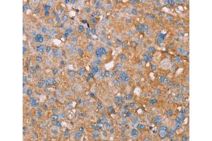 Immunohistochemistry (IHC) image for anti-P Antigen Family, Member 5 (Prostate Associated) (PAGE5) antibody (ABIN2430601) (PAGE5 抗体)