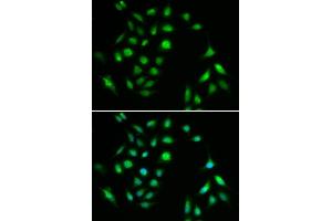 Immunofluorescence analysis of A549 cell using CHUK antibody. (IKK alpha 抗体  (C-Term))