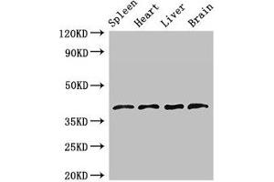 Western Blot Positive WB detected in: Rat spleen tissue, Mouse heart tissue, Mouse liver tissue, Mouse brain tissue All lanes: LEFTY1 antibody at 2. (LEFTY1 抗体  (AA 223-260))