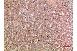 Immunohistochemical analysis of paraffin-embedded human-liver, antibody was diluted at 1:200 (CCR5 抗体  (AA 151-200))