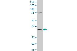 QPRT polyclonal antibody (A01), Lot # 060803QCS1 Western Blot analysis of QPRT expression in K-562 . (QPRT 抗体  (AA 198-297))