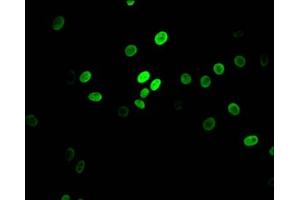 Immunofluorescence staining of HepG2 Cells with ABIN7127634 at 1:50, counter-stained with DAPI. (Recombinant MYBBP1A 抗体)