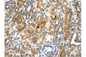 MAS1 antibody was used for immunohistochemistry at a concentration of 4-8 ug/ml. (MAS1 抗体  (Middle Region))