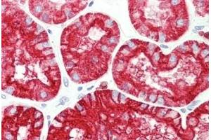 Human Kidney: Formalin-Fixed, Paraffin-Embedded (FFPE) (Aquaporin 1 抗体  (AA 241-269))