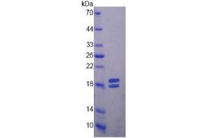 SDS-PAGE (SDS) image for Matrix Metallopeptidase 13 (Collagenase 3) (MMP13) ELISA Kit (ABIN6730942)