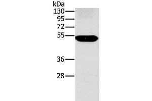 Western Blot analysis of Human placenta tissue using FUCA1 Polyclonal Antibody at dilution of 1:500 (FUCA1 抗体)