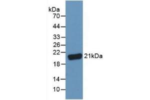Detection of C8g in Human Serum using Polyclonal Antibody to Complement Component 8g (C8g) (C8G 抗体  (AA 39-202))