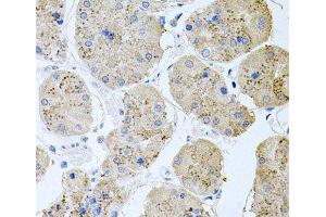 Immunohistochemistry of paraffin-embedded Human stomach using RAPSN Polyclonal Antibody at dilution of 1:100 (40x lens). (RAPSN 抗体)