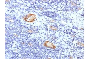Formalin-fixed, paraffin-embedded human Tonsil stained with vWF Rabbit Recombinant Monoclonal Antibody (VWF/1859R). (Recombinant VWF 抗体  (AA 1815-1939))