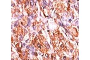 Retinoblastoma Protein (Rb) 抗体  (pSer811)