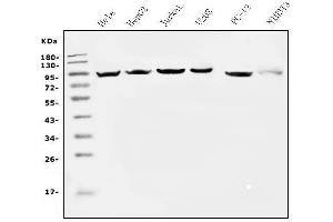 Western blot analysis of EEF2 using anti-EEF2 antibody (ABIN7603141).