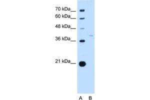 Western Blotting (WB) image for anti-Replication Factor C (Activator 1) 3, 38kDa (RFC3) antibody (ABIN2462934) (RFC3 抗体)