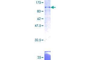 ZBTB43 Protein (AA 1-467) (GST tag)