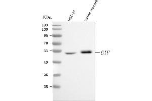 Western blot analysis of CBLIF using anti-CBLIF antibody (ABIN7599904). (CBLIF (AA 128-417) 抗体)