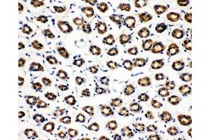 Immunohistochemistry (IHC) image for anti-Succinate Dehydrogenase Complex, Subunit C, Integral Membrane Protein, 15kDa (SDHC) (N-Term) antibody (ABIN3032765)