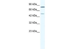 WB Suggested Anti-ZNF12 Antibody Titration:  1. (ZNF12 抗体  (N-Term))