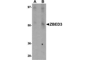 Western blot analysis of ZBED3 in rat lung tissue lysate with this product at (A) 1 and (B) 2 μg/ml. (ZBED3 抗体  (N-Term))