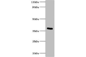 Western blot All lanes: Bordella pertussis pertussis toxin subunit 1 antibody at 2 μg/mL + recombinant Bordella pertussis pertussis toxin subunit 1 100 ng Secondary Goat polyclonal to rabbit IgG at 1/1000 dilution Predicted band size: 36 kDa Observed band size: 36 kDa (PtxA (AA 35-269) 抗体)