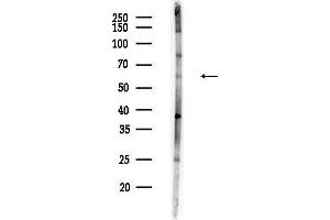 Western blot analysis of lysates from F10-LUC cells(UV,30 min treatment), using CHMP7 Antibody at 1/1000 dilution.