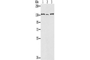 Gel: 6 % SDS-PAGE, Lysate: 40 μg, Lane 1-3: Hela cells, 231 cells, A172 cells, Primary antibody: ABIN7130904(RNF40 Antibody) at dilution 1/400, Secondary antibody: Goat anti rabbit IgG at 1/8000 dilution, Exposure time: 1 minute (RNF4 抗体)