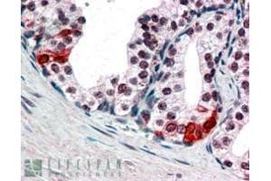 In paraffin embedded Human Prostate shows nuclear staining in secretory epithelial cells.