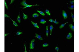 Immunofluorescence staining of U251 cells with ABIN7146077 at 1:250, counter-stained with DAPI. (CLEC4E 抗体  (AA 41-219))