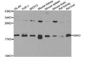 Western blot analysis of extracts of various cell lines, using SNX3 antibody. (Sorting Nexin 3 抗体)