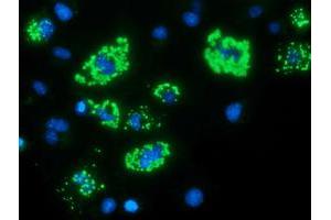 Anti-MYD88 mouse monoclonal antibody (ABIN2453996) immunofluorescent staining of COS7 cells transiently transfected by pCMV6-ENTRY MYD88 (RC202253). (MYD88 抗体)