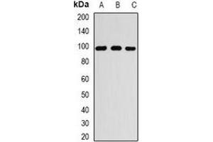 Western blot analysis of RANGAP1 expression in MCF7 (A), A549 (B), Jurkat (C) whole cell lysates.