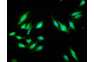 Immunofluorescence staining of Hela cells with ABIN7146907 at 1:100, counter-stained with DAPI. (CARD14 抗体  (AA 249-523))