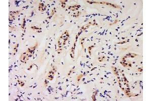 Formalin-fixed and paraffin embedded human kidney labeled with Anti-GSS/Glutathione Synthetase Polyclonal Antibody, Unconjugated  at 1:200 followed by conjugation to the secondary antibody and DAB staining. (Glutathione Synthetase 抗体  (AA 81-160))