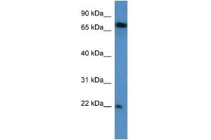 WB Suggested Anti-SFT2D3 Antibody Titration: 0.