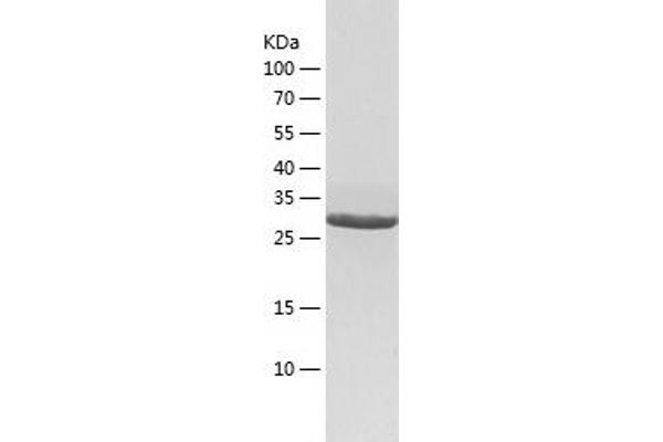 LRPAP1 Protein (AA 35-357) (His tag)