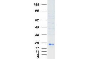 Western Blotting (WB) image for Ephrin A1 (EFNA1) (Transcript Variant 1) protein (Myc-DYKDDDDK Tag) (ABIN2720256)