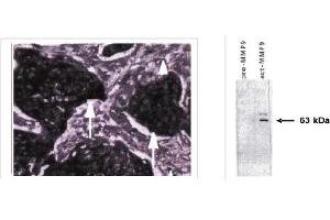 Immunohistochemistry (IHC) image for anti-Matrix Metallopeptidase 9 (Gelatinase B, 92kDa Gelatinase, 92kDa Type IV Collagenase) (MMP9) (active), (N-Term) antibody (ABIN264508) (MMP 9 抗体  (active, N-Term))