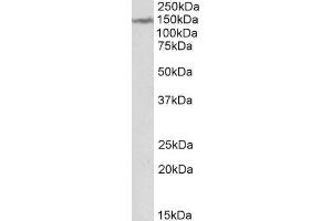 ABIN571234 (2µg/ml) staining of Human Cerebellum lysate (35µg protein in RIPA buffer). (LMTK2 抗体  (Internal Region))