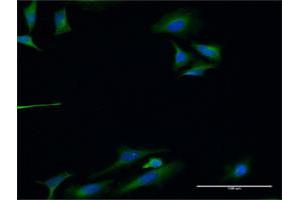 Immunofluorescence of monoclonal antibody to TLN1 on HeLa cell. (TLN1 抗体  (AA 1324-1424))