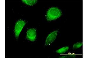 Immunofluorescence of monoclonal antibody to CLCN6 on HeLa cell.