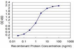 Detection limit for recombinant GST tagged SURB7 is approximately 0. (MED21 抗体  (AA 1-144))