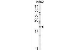 Western Blotting (WB) image for anti-BTG Family, Member 2 (BTG2) antibody (ABIN2995530) (BTG2 抗体)