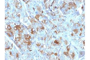 Formalin-fixed, paraffin-embedded human Adrenal Gland stained with Chromogranin A Mouse Monoclonal Antibody (CHGA/777) (Chromogranin A 抗体)