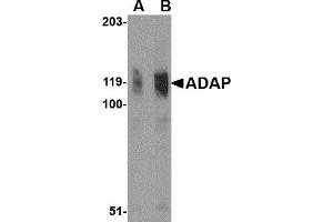Image no. 1 for anti-FYN-Binding Protein (FYB) (N-Term) antibody (ABIN203719) (FYB 抗体  (N-Term))