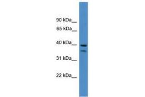 Image no. 1 for anti-serpin Peptidase Inhibitor, Clade B (Ovalbumin), Member 6 (SERPINB6) (AA 161-210) antibody (ABIN6745378) (SERPINB6 抗体  (AA 161-210))