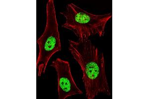 Fluorescent image of Hela cells stained with ARA Antibody (ABIN1944858 and ABIN2838532). (PPARA 抗体  (AA 1-468))