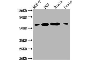 Western Blot Positive WB detected in: MCF-7 whole cell lysate, PC3 whole cell lysate, Mouse brain tissue, Rat brain tissue All lanes: LOXL2 antibody at 1:2000 Secondary Goat polyclonal to rabbit IgG at 1/50000 dilution Predicted band size: 87 kDa Observed band size: 53 kDa (Recombinant LOXL2 抗体)