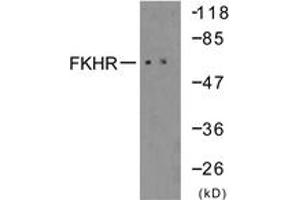 Western blot analysis of extracts from 293 cells, treated with serum 10% 15', using FKHR (Ab-319) Antibody. (FOXO1 抗体  (AA 286-335))