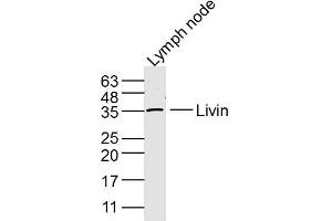 Mouse Lymph node lysates probed with Livin Polyclonal Antibody, Unconjugated  at 1:300 dilution and 4˚C overnight incubation. (BIRC7 抗体  (AA 101-200))